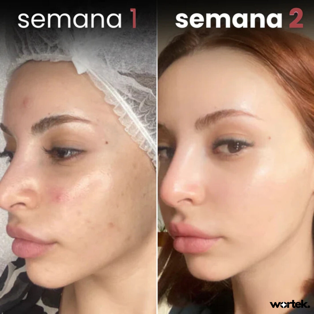 Crema Antiedad Dragón™