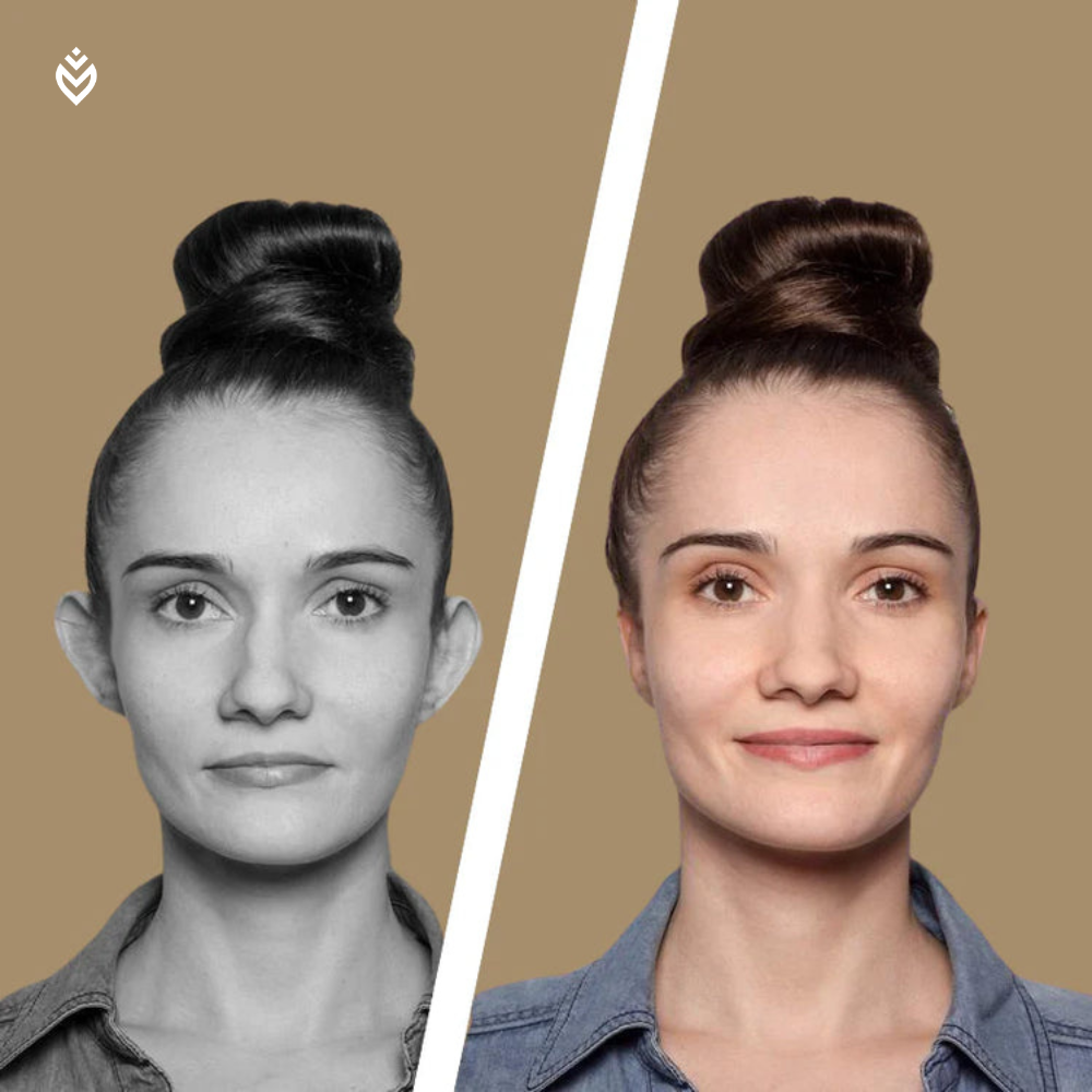 YouCure™ Corrector de orejas certificado (Pack 8 unidades / 1 a 2 meses)